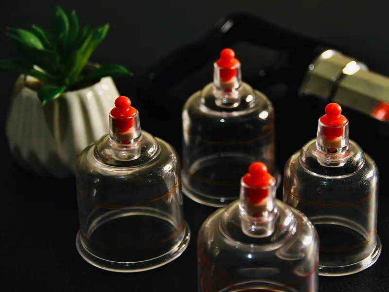 How Cupping Therapy works at Nokomis Chiropractic and Wellness