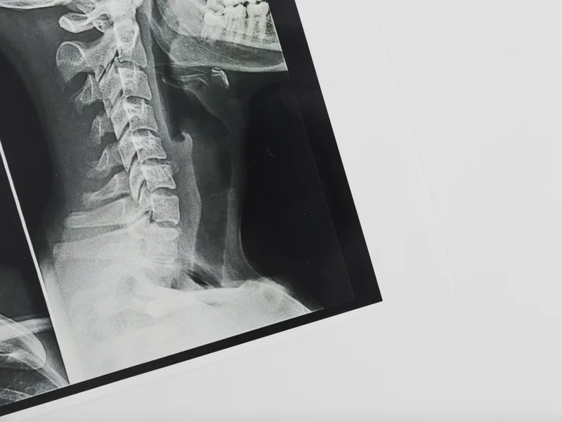 X-Rays at Nokomis Chiropractic and Wellness in Minneapolis