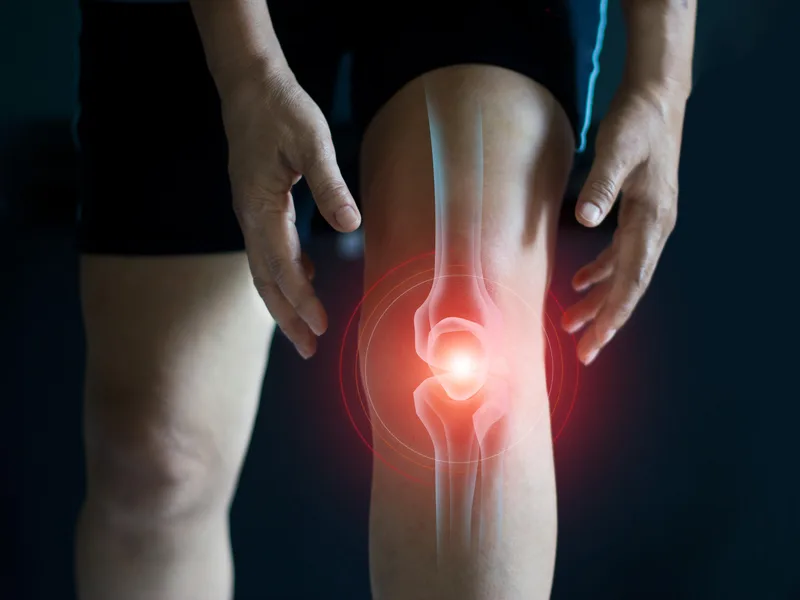 How Nokomis Chiropractic and Wellness treats arthritis in Minneapolis